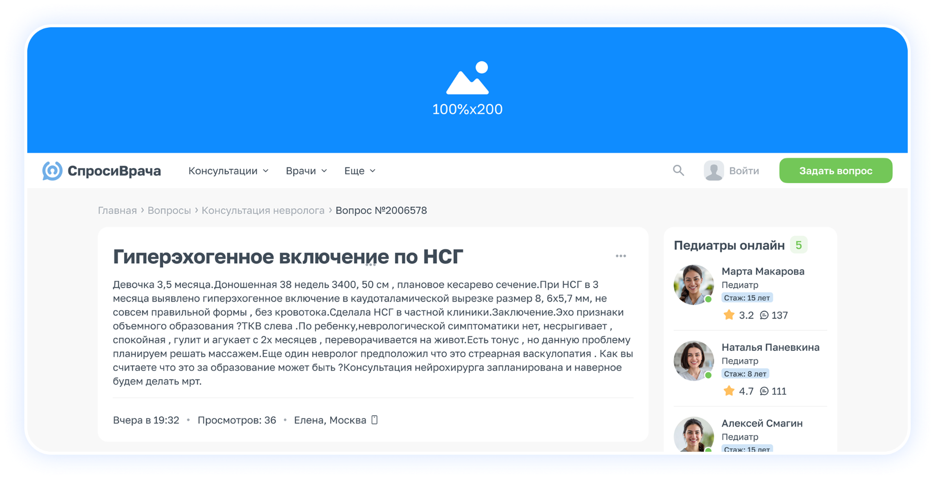 Верхняя перетяжка