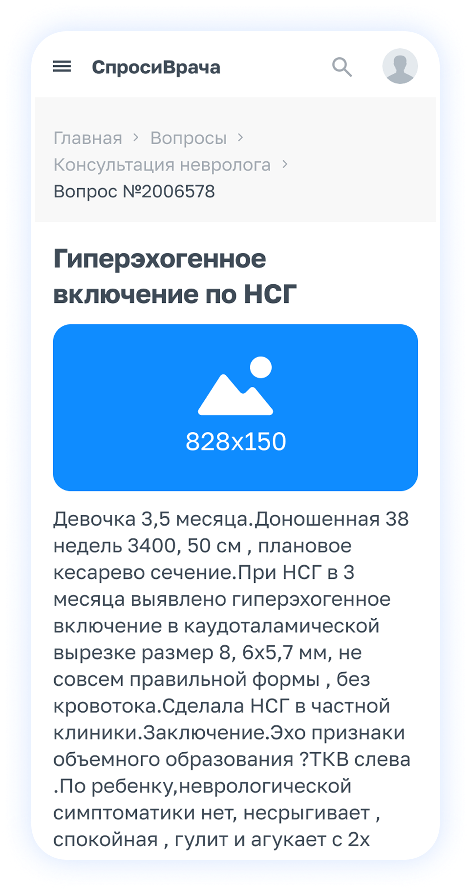 Мобильная версия размещения